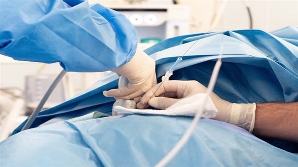 علاج أكياس الكبد
