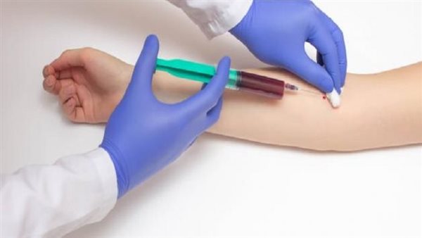 أعراض ارتفاع البروتين