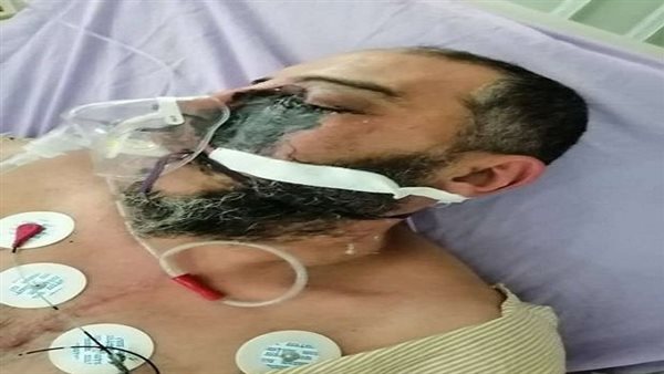 علاج الفطر الأسود