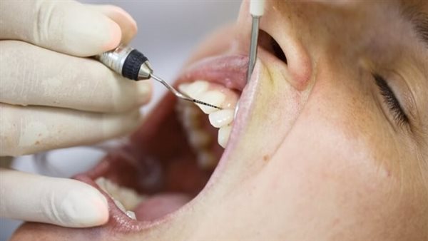 علاج انحسار اللثة