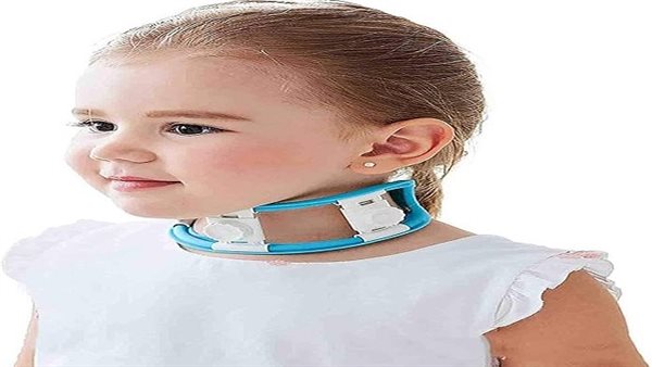 كيف يتم علاج الصعر؟