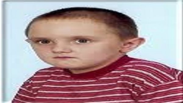 ما هي أسباب متلازمة